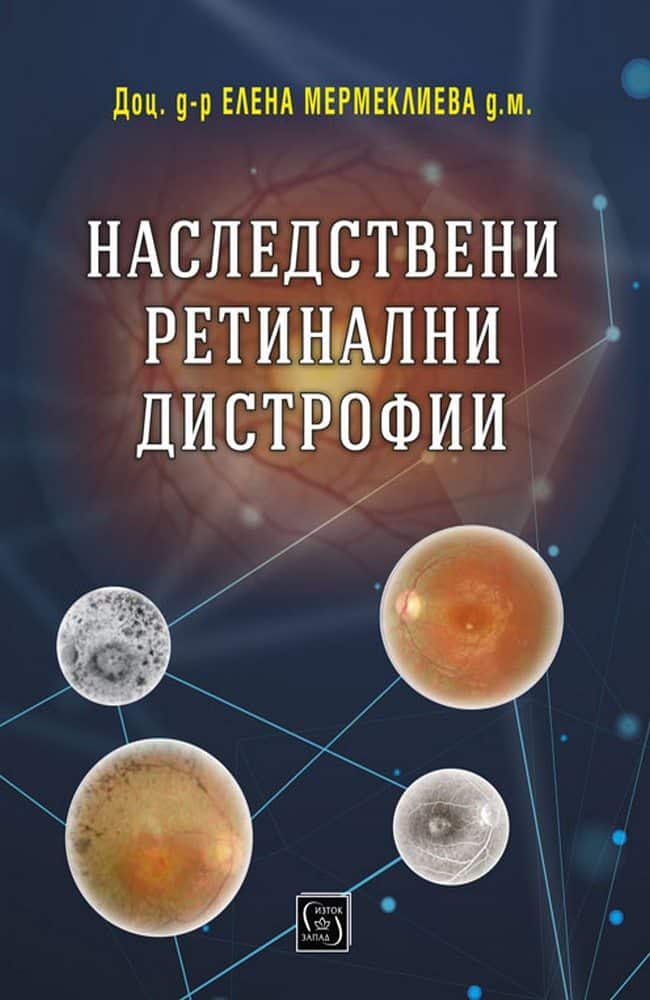 Наследствени ретинални дистрофии Наследствени ретинални дистрофии